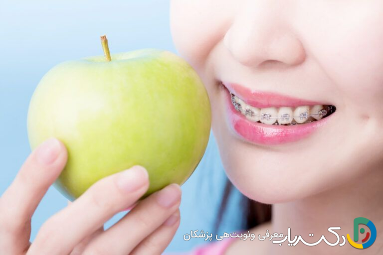 آیا باید رژیم غذایی خاصی برای ارتودنسی داشته باشیم؟